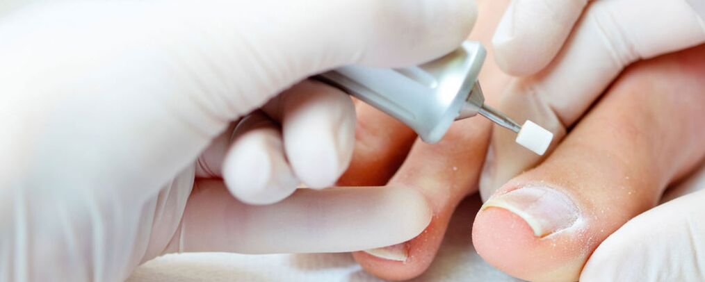 Coupez la couche supérieure de l'ongle